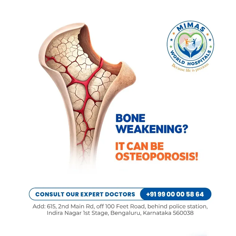 Bone weakening and osteoporosis awareness post designed by Diglizer Solution for MIMAS World Hospitals